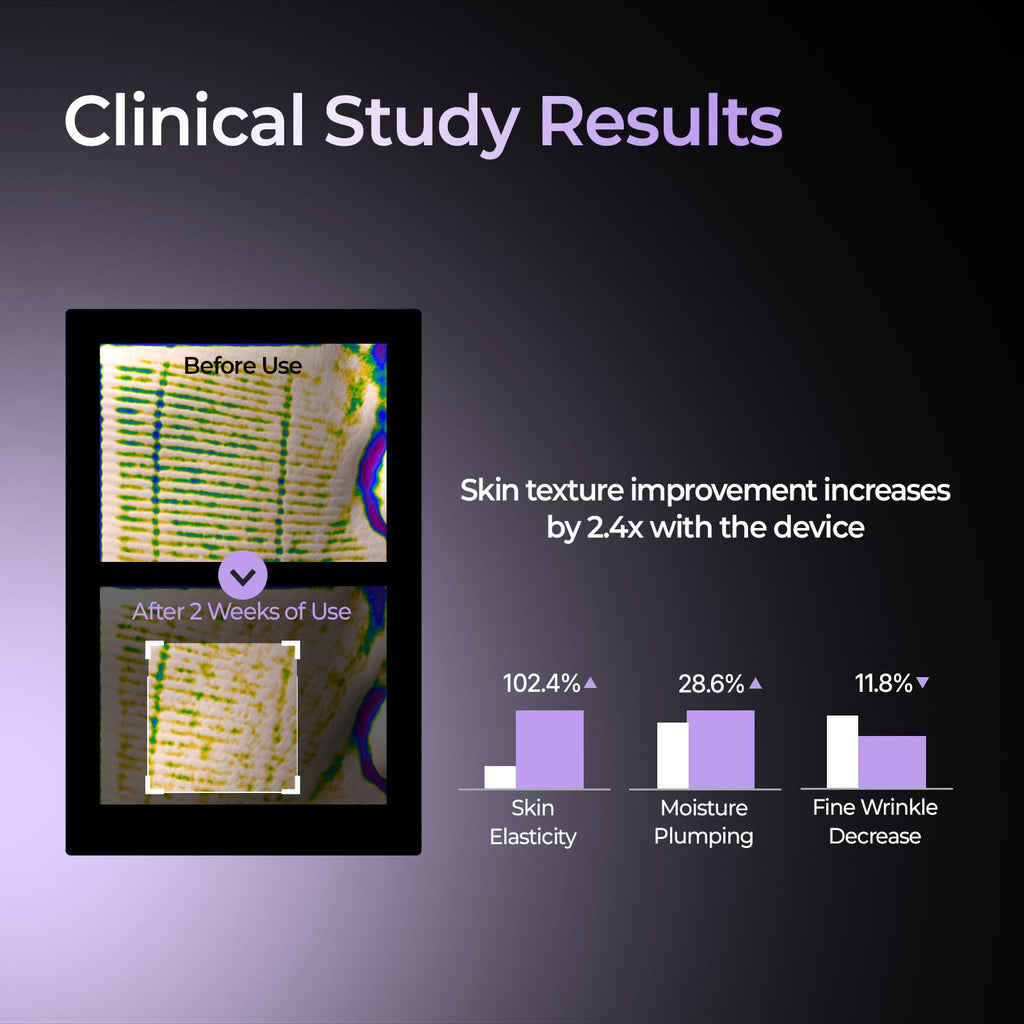 Aalok SKINMAX Facial Device and 03 Rejuvenating Elasticity SKINMAX Serum (Device + Serum)